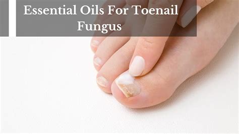Black Toenail Fungus