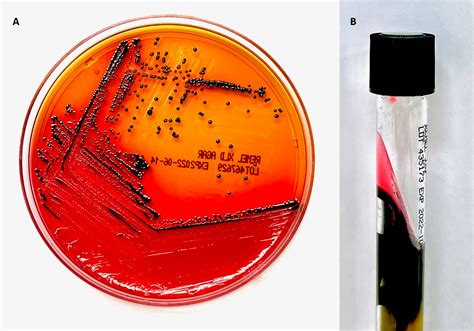 Triple Sugar Iron Agar Prepared Media Triple Sugar Iron Agar Slant