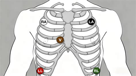 5 Lead ECG Placement: Colors, Mnemonics & Steps | Medlinket