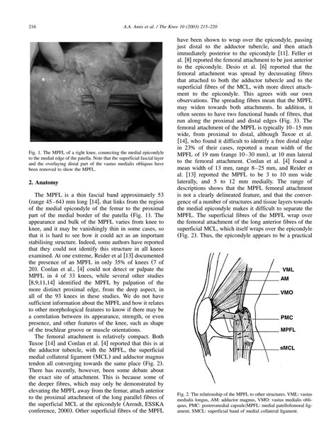 SOLUTION: Anatomy and biomechanics of the medial patellofemoral ...