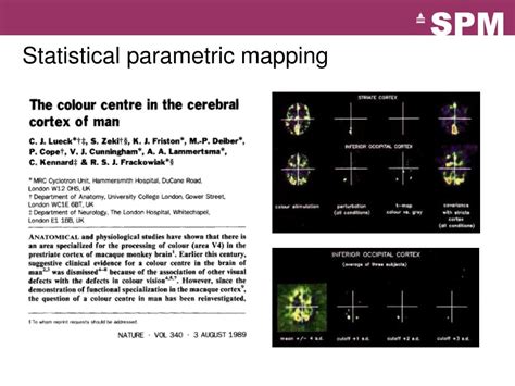 Statistical Parametric Mapping 的图像结果