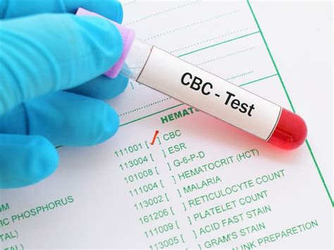CBC Lab Test 的图像结果