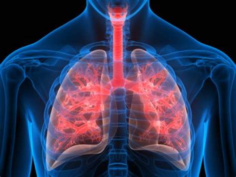 Tuberculosis: How improved nutrition can reduce TB cases? | The Times ...