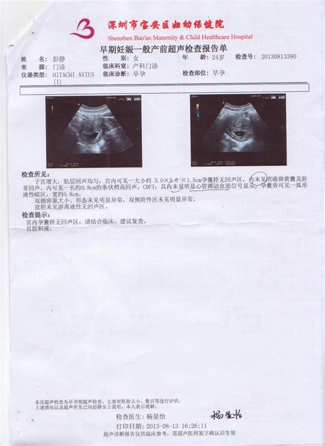 这个孕11周+的胎儿，调皮得不得了！_胎儿