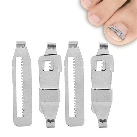 Amazon.com: Ingrowing Nail Corrector, Ingrown Toenail Brace, 2PCS Ingrown Toenail Corrector ...
