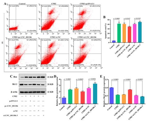 Identification of a Novel lncRNA LNC_001186 and Its Effects on CPB2 ...