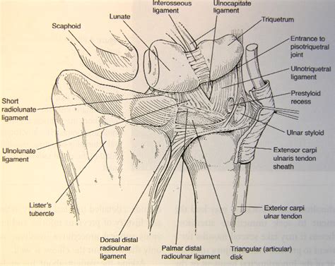 Ulnar-Sided Wrist Pain: Evaluation and Treatment of Triangular ...