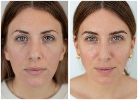 Roc Retinol Makeupalley | Saubhaya Makeup