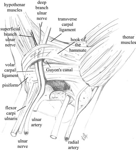 Ulnar Nerve - Clinical Tree