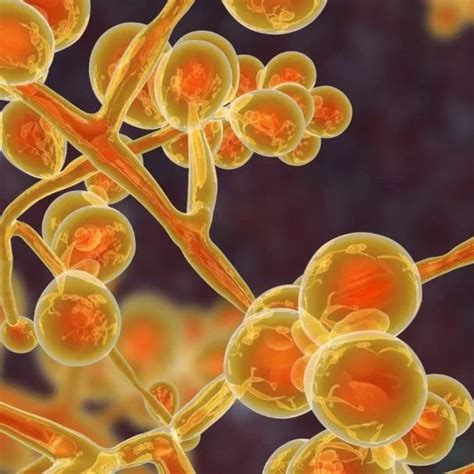 警惕! CDC: 一种致命真菌在疫情期间迅速传播！！老年人特别要小心！ | Redian News