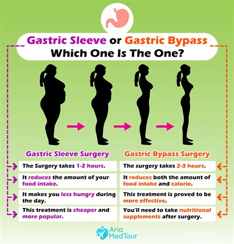 Gastric Bypass Vs Gastric Sleeve: A Close Comparison | AriaMedTour