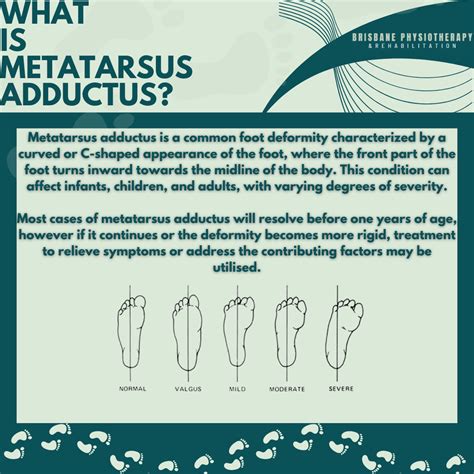 Metatarsus Adductus Metatarsus Varus Or Adductus – KevinRoot Medical