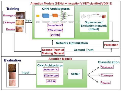 An Enhanced Diagnosis of Monkeypox Disease Using Deep Learning and a ...