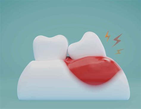 gum hurts where tooth was removed years ago - crystalline Dental