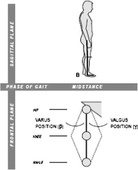 Varus Vs Valgus Valgus Knee Hi Res Stock Photography And Images