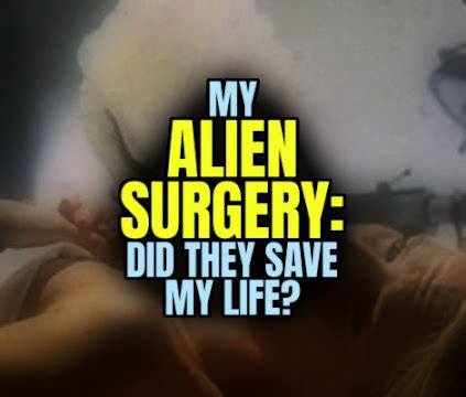Image result for Alien Stomach Experiment Surgery