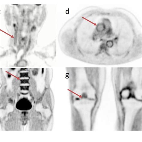 Image result for Total Body Scan