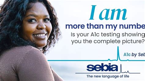 Image result for Sebia Where