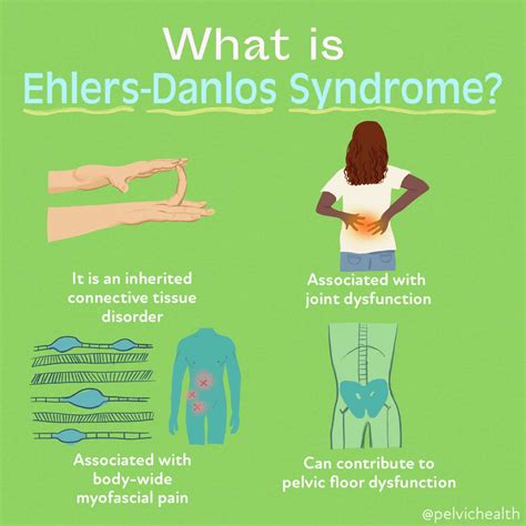 Ehlersdanlos Syndrome Medication