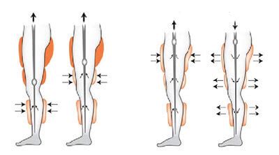 EECP Treatment | EECP Treatment Near Me | EECP Treatment in India ...