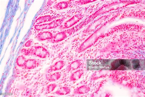 Image result for Jejunum Microscope