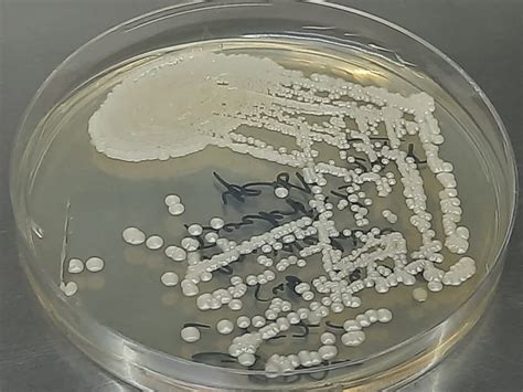 Yeast Identification by MALDI-TOF (VITEK): Introduction, Principle