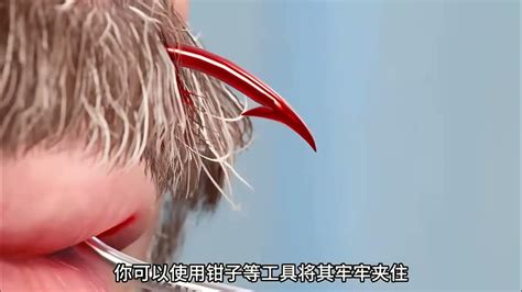 Image result for String Yank Method