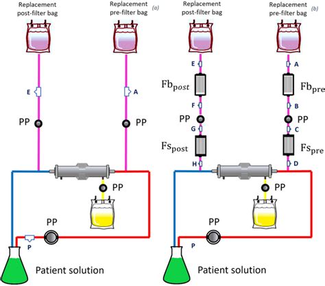 CRRT Recirculation 的图像结果