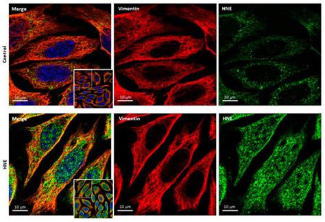 Post-Translational Modifications Evoked by Reactive Carbonyl Species in ...