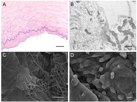 Tissue-Engineered Grafts from Human Decellularized Extracellular ...