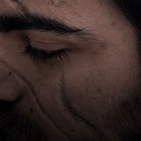 𝖺𝖾𝗌𝗍𝗁𝖾𝗍𝗂𝖼 : 𝐤𝐚𝐞𝐥 𝐫𝐡𝐚𝐝𝐨𝐦𝐢𝐫 | Face scars, Scar, Eye scar