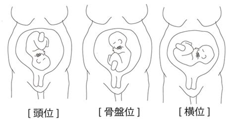 胎位、胎向、胎勢の違い - つねぴーblog＠内科専攻医