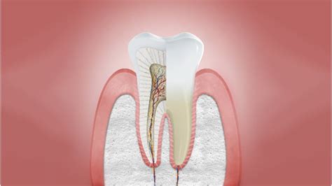 Causes of Gingivitis, Periodontitis & Gum Disease | Haleon HealthPartner