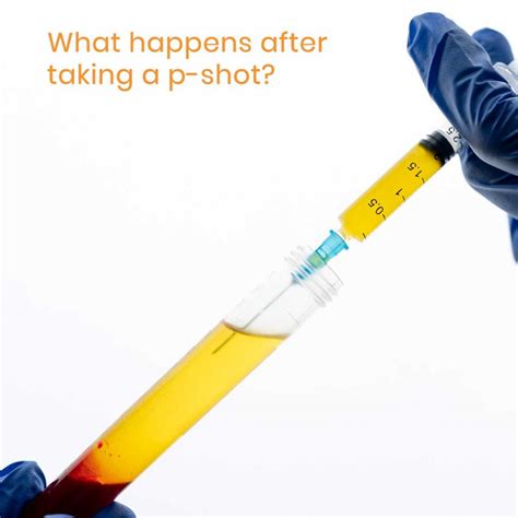 What actually happens during and after the P-shot procedure? | Metromale Clinic & Fertility Center