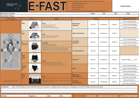 Image result for Efast Tutorial