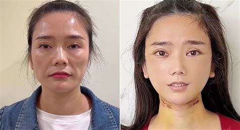 Plastic surgeon Dr. Kim goes viral on TikTok for dramatic before and ...