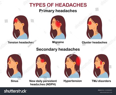 Headache Symptoms Chart