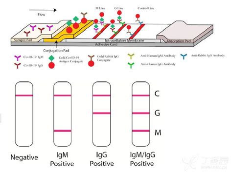 分享来自丁香园的一篇优质讨论文章--【讨论】新冠病毒抗体检测IgG/IgM-假阳性？