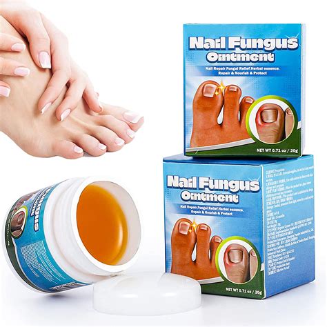 Fungal Nail Treatment Cream at Charles Dunaway blog