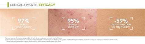 Bioderma Moisturizer for Acne, Redness (Oily Skin) 40ml : Amazon.in ...