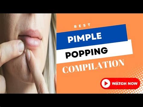 Image result for Exploding Pimples 2017