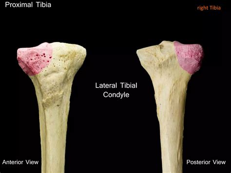 Slideshow: Tibia | PPTX