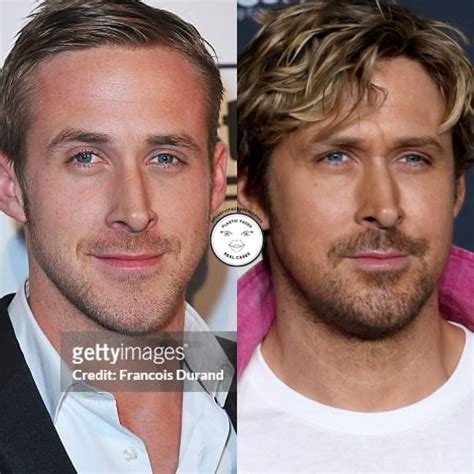 Ryan Gosling Rinoplastica Ryan Gosling Plastic Surgery: Subtle