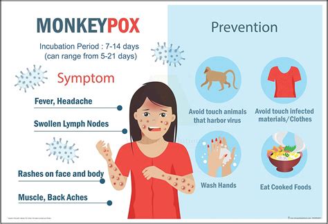 Anne Print Solutions® Monkeypox prevention chart Posters For Hospital ...