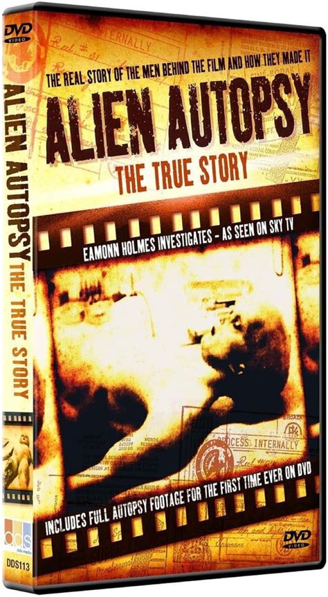 Image result for Alien Autopsy 1947 Video Gary Shoefield