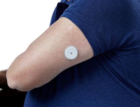 best wearable technology
