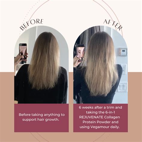 Does Collagen Help Hair Growth