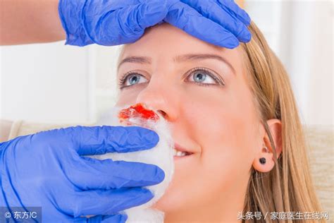 鼻孔出血正确处理方法（突然鼻出血，仰头、举手都不对，正确的方法分2步） | 说明书网