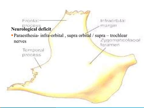 Management of zygomaticomaxillary complex fractures ih | PPTX