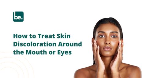 How to Treat Skin Discoloration Around the Mouth or Eyes – Belogical ...